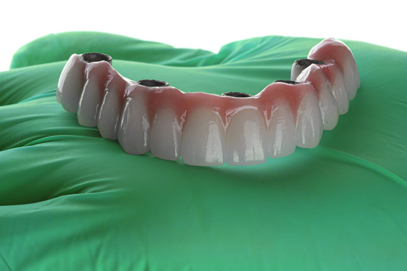 a full arch of teeth with 4 holes for dental implants to be placed