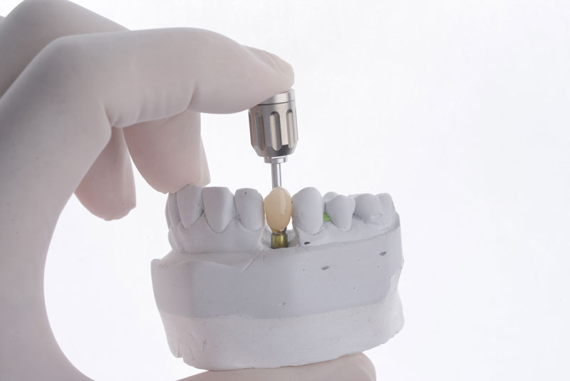 a single dental implant with a drill attachment being shown
