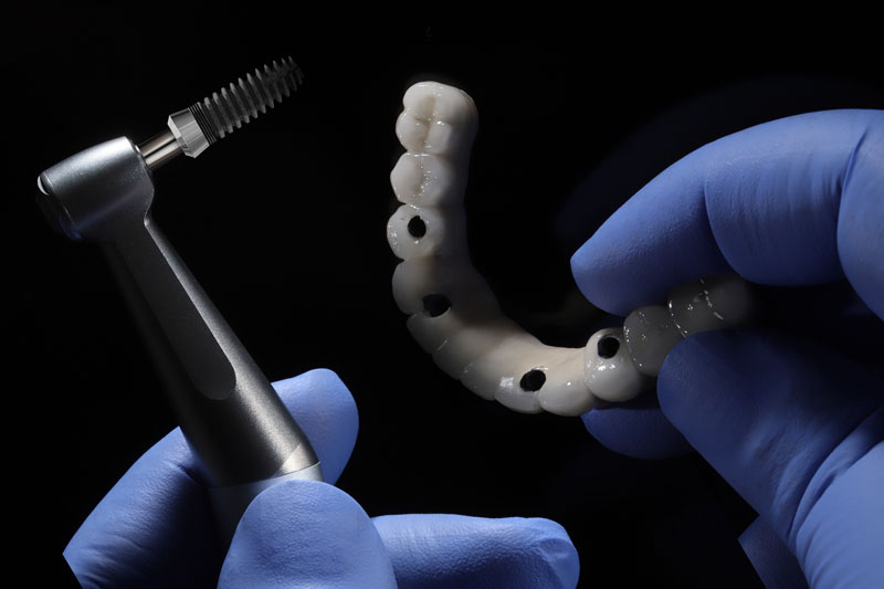 a full arch of teeth with 4 holes for implants to be placed in the jaw