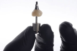 a single dental implant with a crown being placed on top with a drill