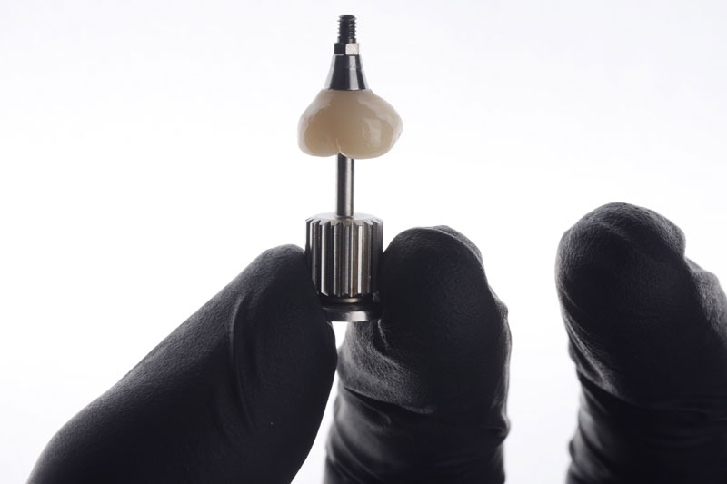 a single dental implant with a crown being placed on top with a drill