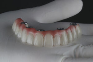 a full arch of dental implants with holes for implants to be placed into the jaw