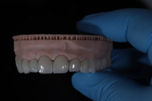 a full arch of teeth being held up by a dentist with a glove on