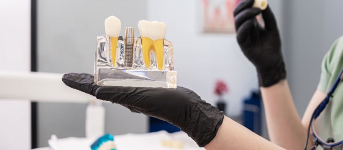 A dental professional in black gloves holds a clear model showing a dental implant with the post and crown. The modern clinic setting emphasizes advanced dental care and education.