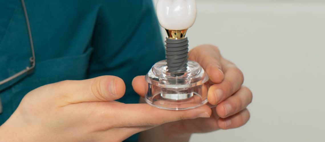 Dentist holding a dental implant in his hands, the dental implant model is oversized to see the details