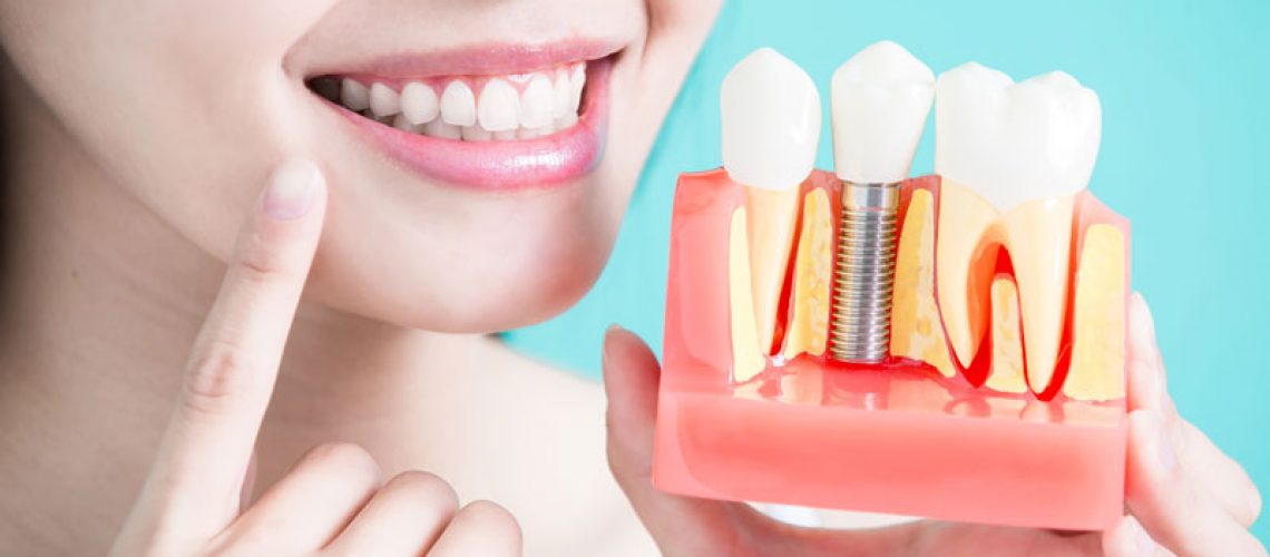 Patient With Dental Implant Model