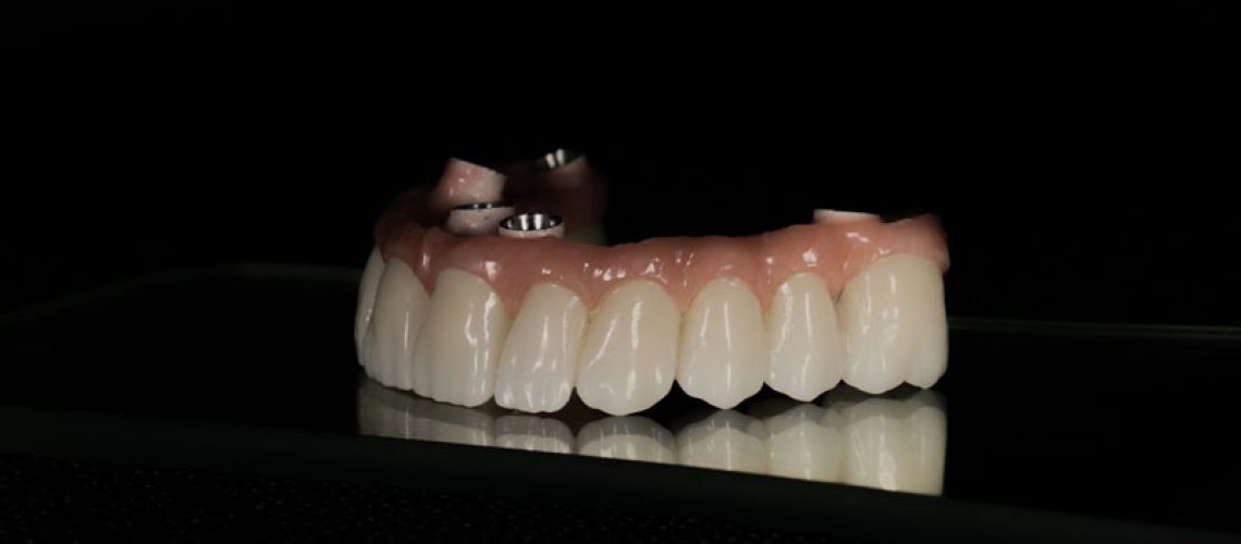 a full arch of zirconia teeth with holes for implants to be placed
