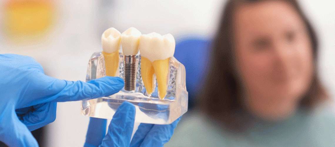 Close-up of dental model with implant. patient of dental clinic on blurred background.