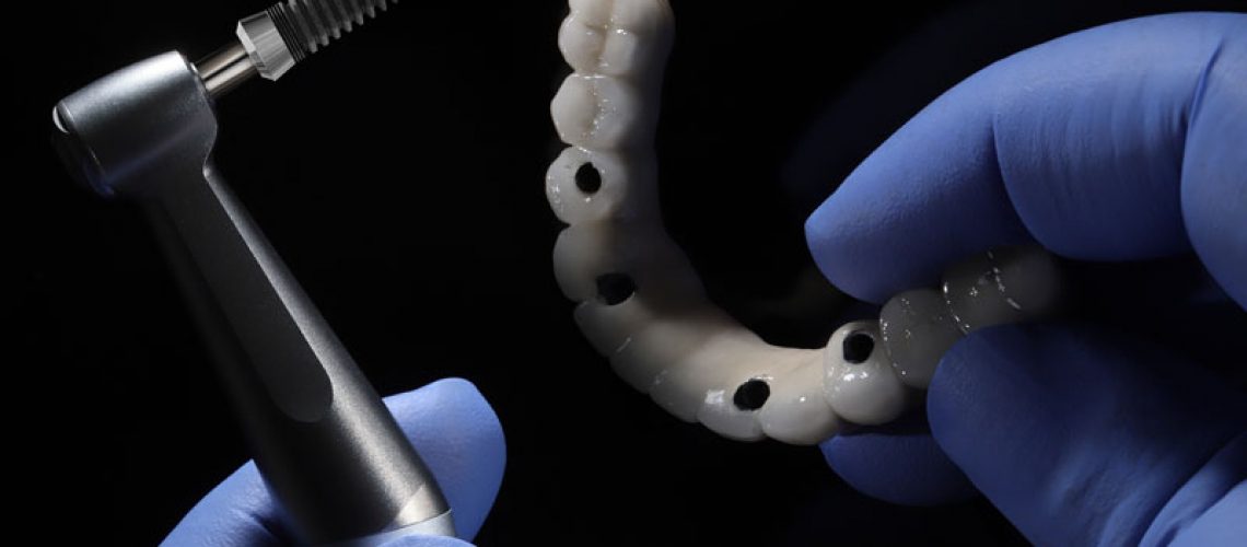 a full arch of teeth with 4 holes for implants to be placed in the jaw