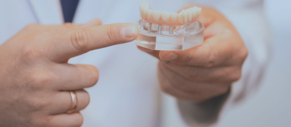 dental implant model.