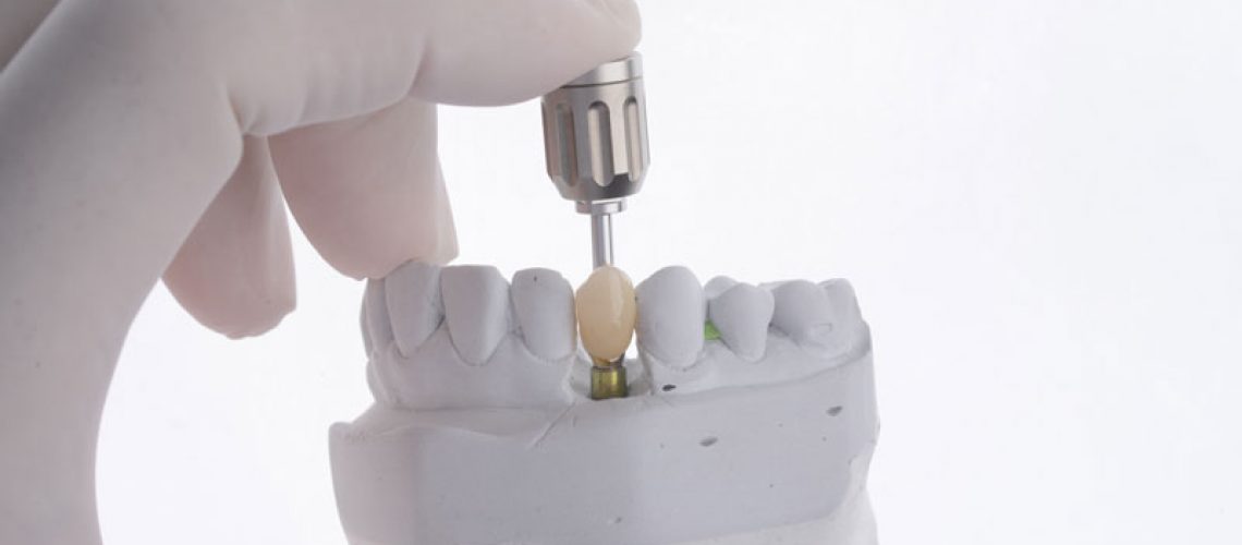 a single dental implant with a drill attachment being shown