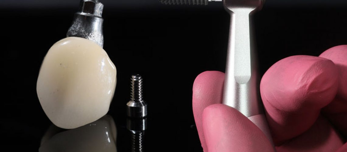a single dental implant with a dentist holding up a tool to place the implants